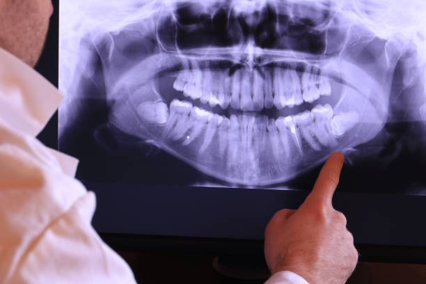 Best Urgent Dental Care for Toothaches in Union Point, GA
